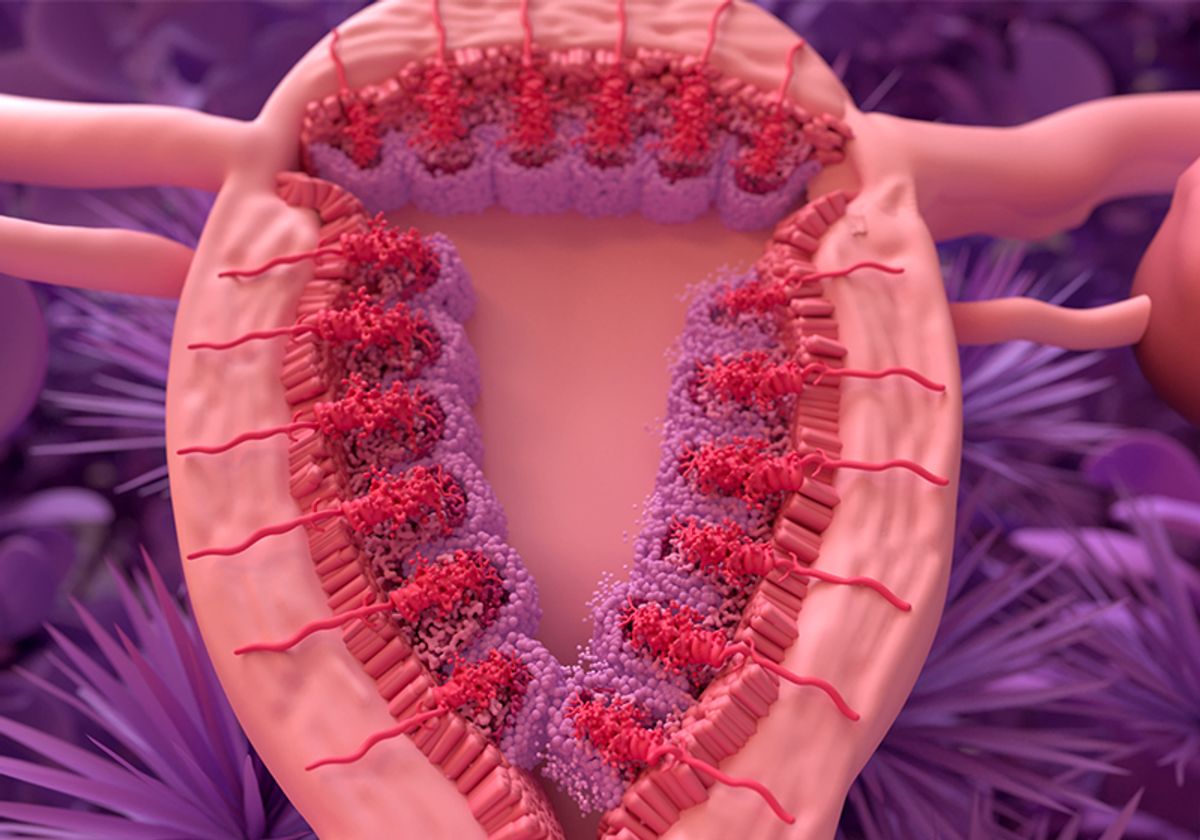 Stylized uterine cross section, showing endometrial layers and buildup of the uterine lining before menstruation. Stylized uterine cross section, showing endometrial layers and buildup of the uterine lining before menstruation.