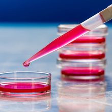 Discover real-time imaging solutions for studying cell biology