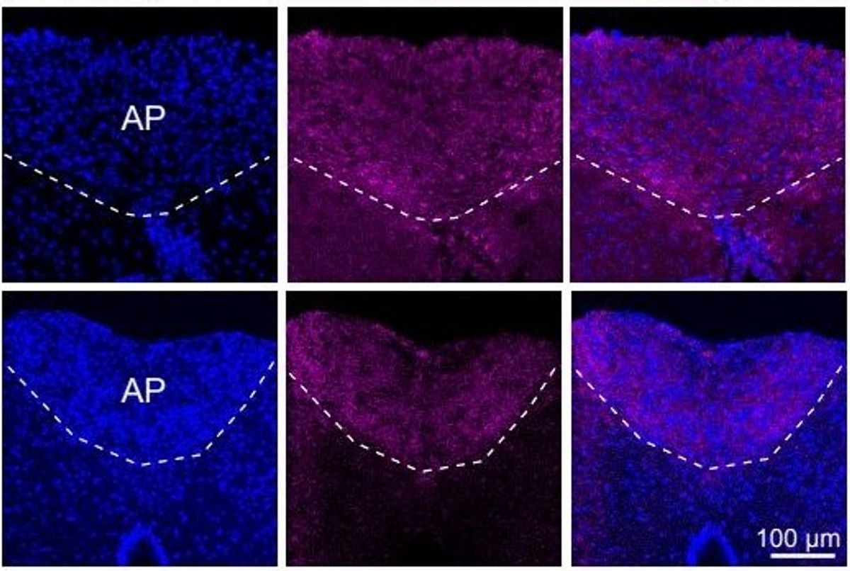 Interleukin-6, a multi-function molecule associated with cachexia, is visualized in the brain of healthy and cachectic mice. Interleukin-6, a multi-function molecule associated with cachexia, is visualized in the brain of healthy and cachectic mice.