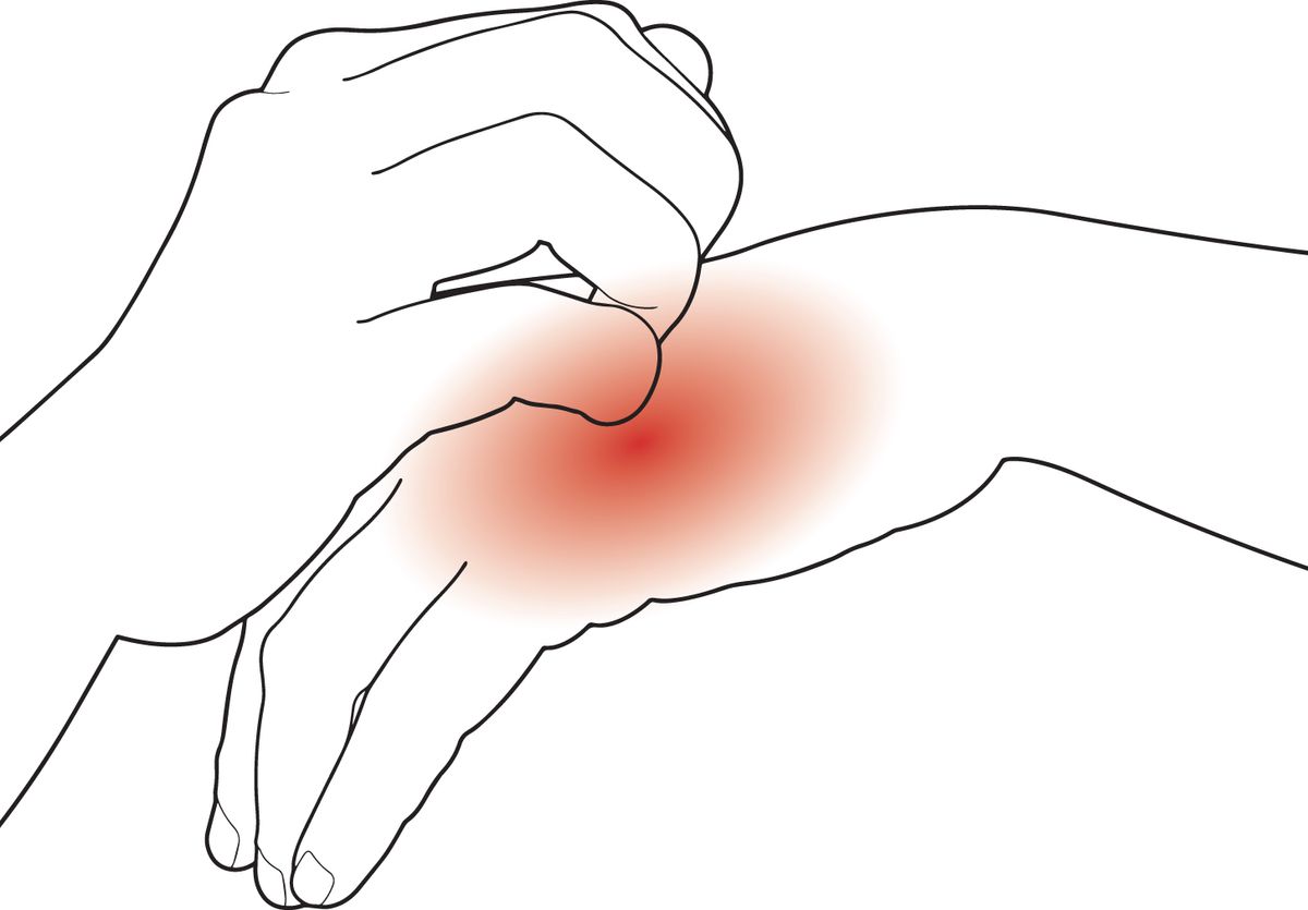Illustration of hands scratching. Illustration of hands scratching.