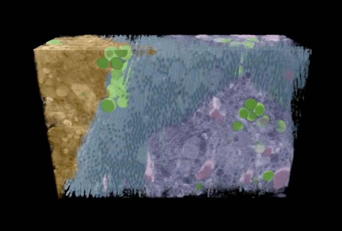 A blue cuboid reconstruction of mussel tissue with round plaque vesicles shown in green. A blue cuboid reconstruction of mussel tissue with round plaque vesicles shown in green.