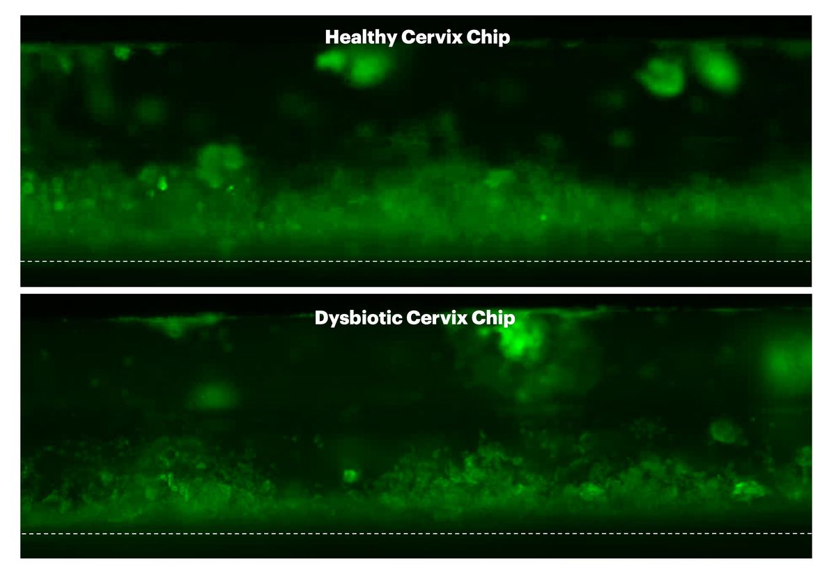Two images showing a green-colored layer against a black background. The green layer in the top image is thicker than that in the bottom one. Two images showing a green-colored layer against a black background. The green layer in the top image is thicker than that in the bottom one.