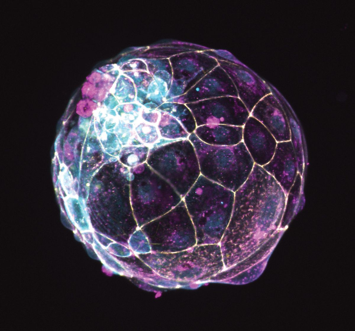 Fluorescent image of a blastoid with yellow, magenta, and cyan labels. Fluorescent image of a blastoid with yellow, magenta, and cyan labels.
