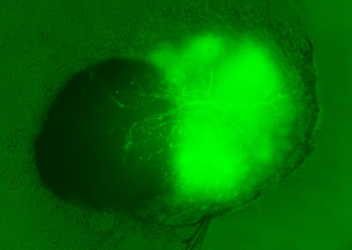 A bright green ball on the right appears to invade a dark sphere against a green background. A bright green ball on the right appears to invade a dark sphere against a green background.