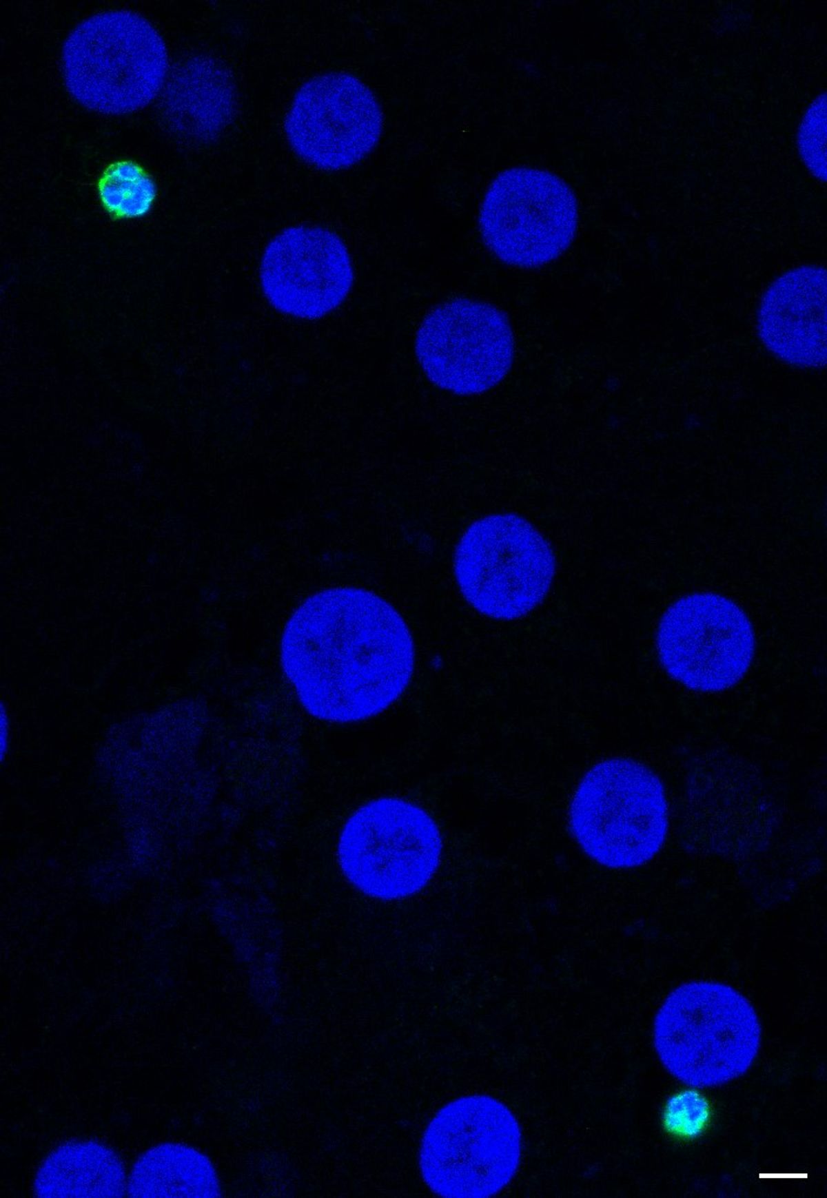 Blue circles and one bright green circle on a black background. Blue circles and one bright green circle on a black background.