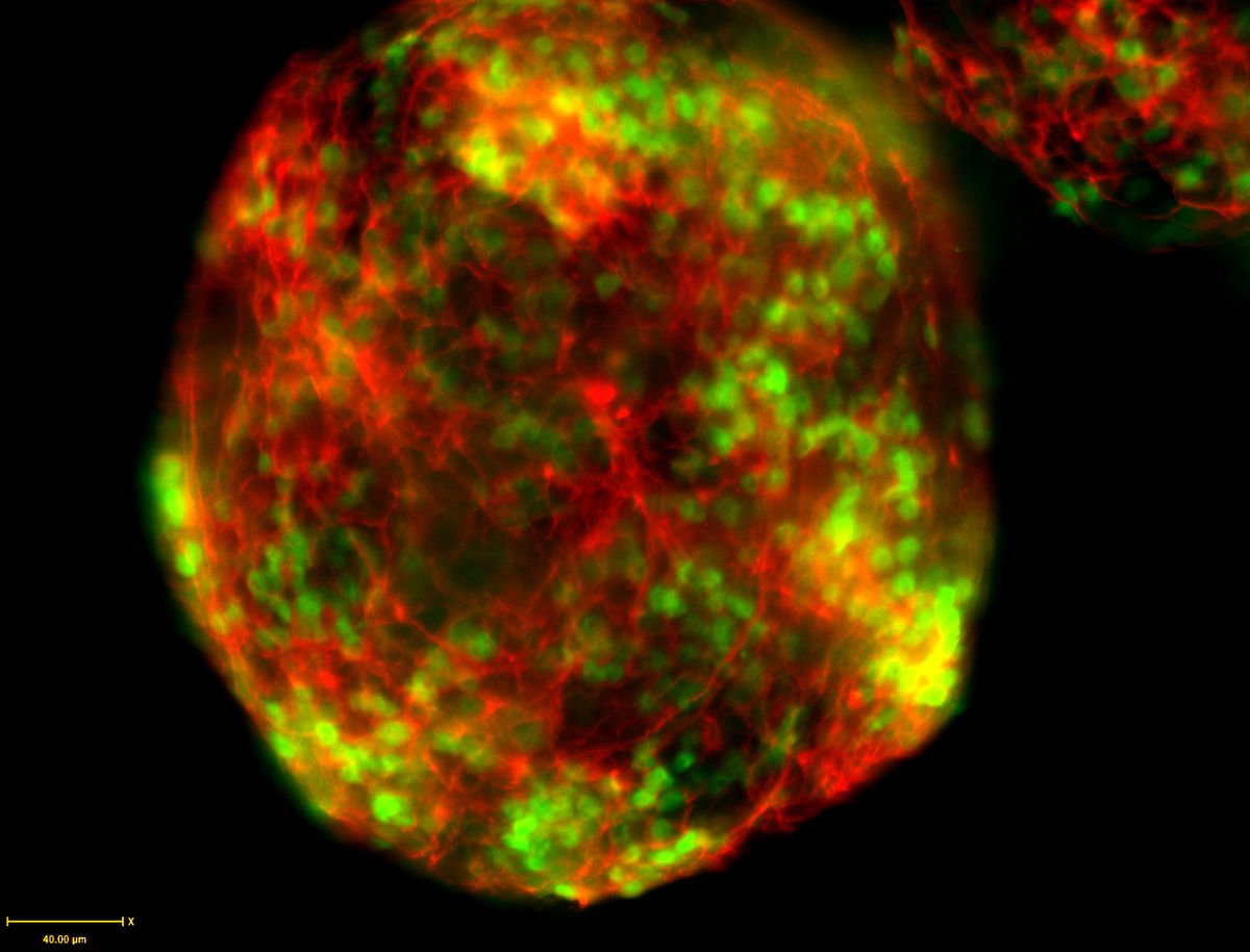 Red fluorescing neurons form a spiderweb-like sphere across mouse embryonic stem cells, where some cells are also expressing green fluorescent protein (GFP). Red fluorescing neurons form a spiderweb-like sphere across mouse embryonic stem cells, where some cells are also expressing green fluorescent protein (GFP).