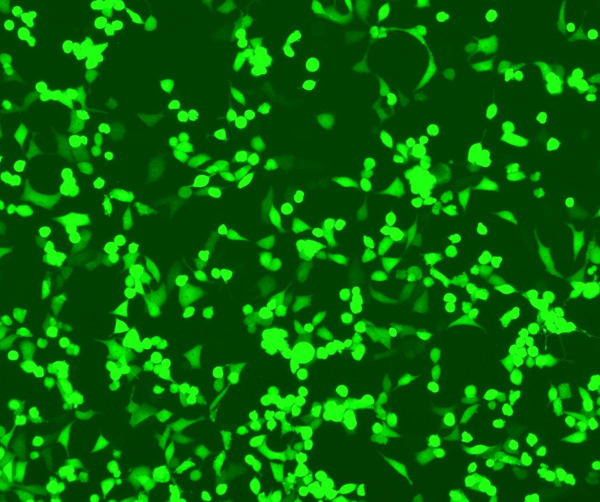 Fluorescent microscopy image of mammalian cells expressing bright green GFP. Fluorescent microscopy image of mammalian cells expressing bright green GFP.