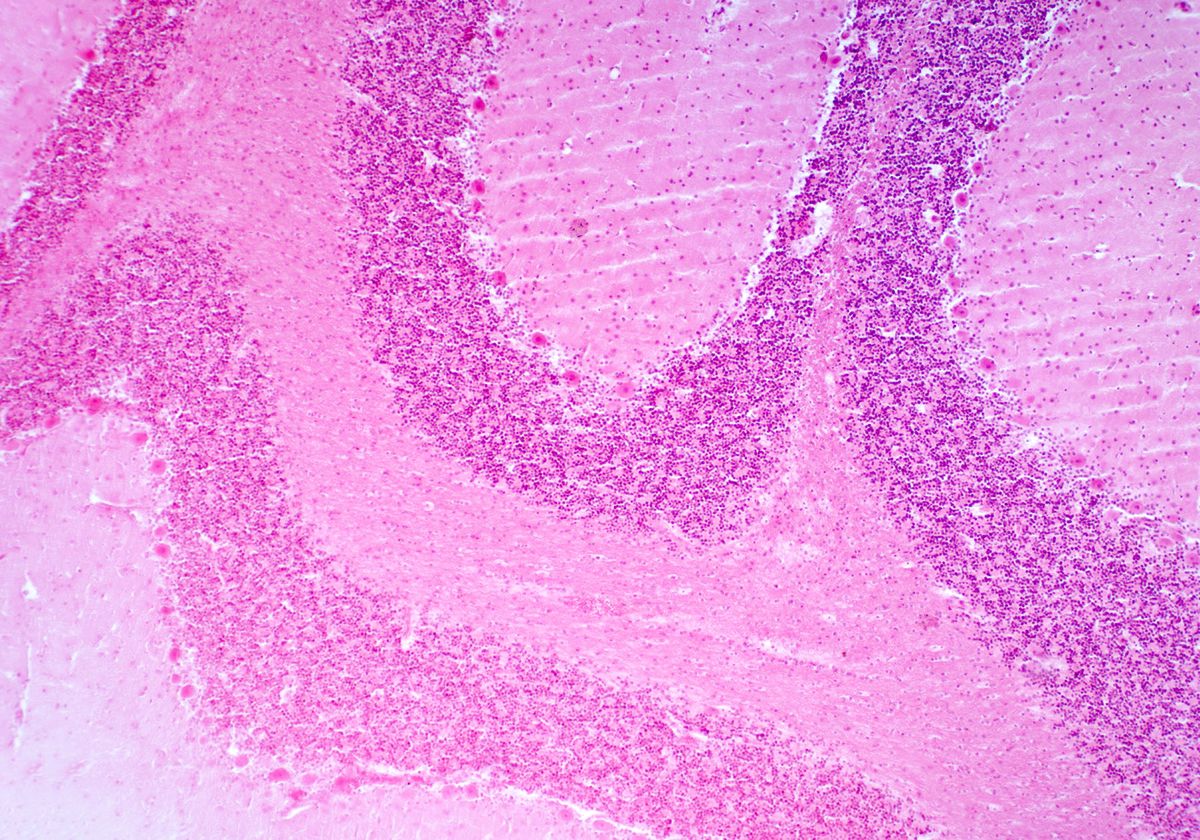Histology cross section of cerebellum tissue stained in pink and viewed under a light microscope. Histology cross section of cerebellum tissue stained in pink and viewed under a light microscope.