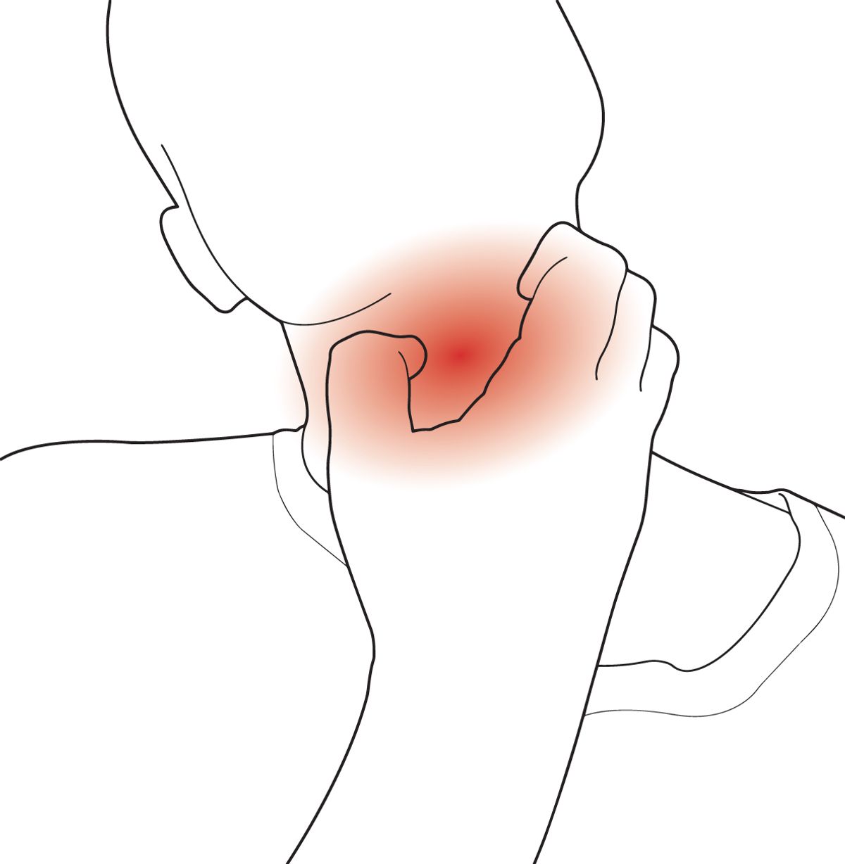 ?Illustration ?of an itchy throat. ?Illustration ?of an itchy throat.