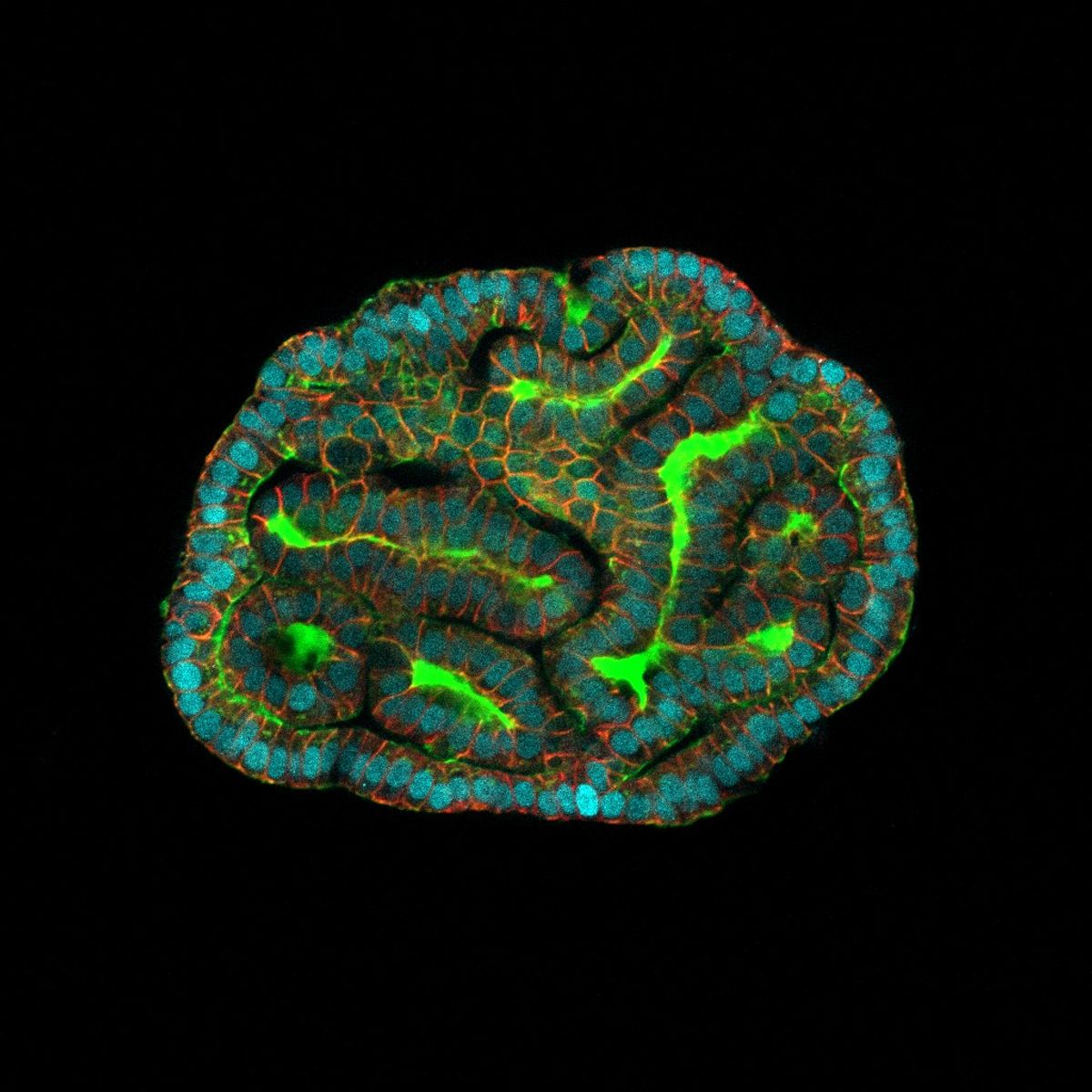 Cluster of blue cells encasing green tube structures. Cluster of blue cells encasing green tube structures.