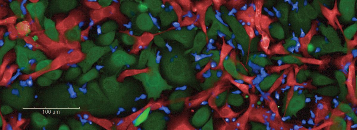 A web of red, green, and blue cells in close proximity. A web of red, green, and blue cells in close proximity.