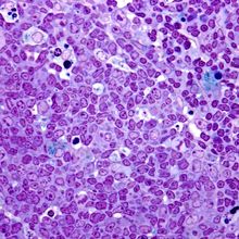 A germinal center inside a lymph node