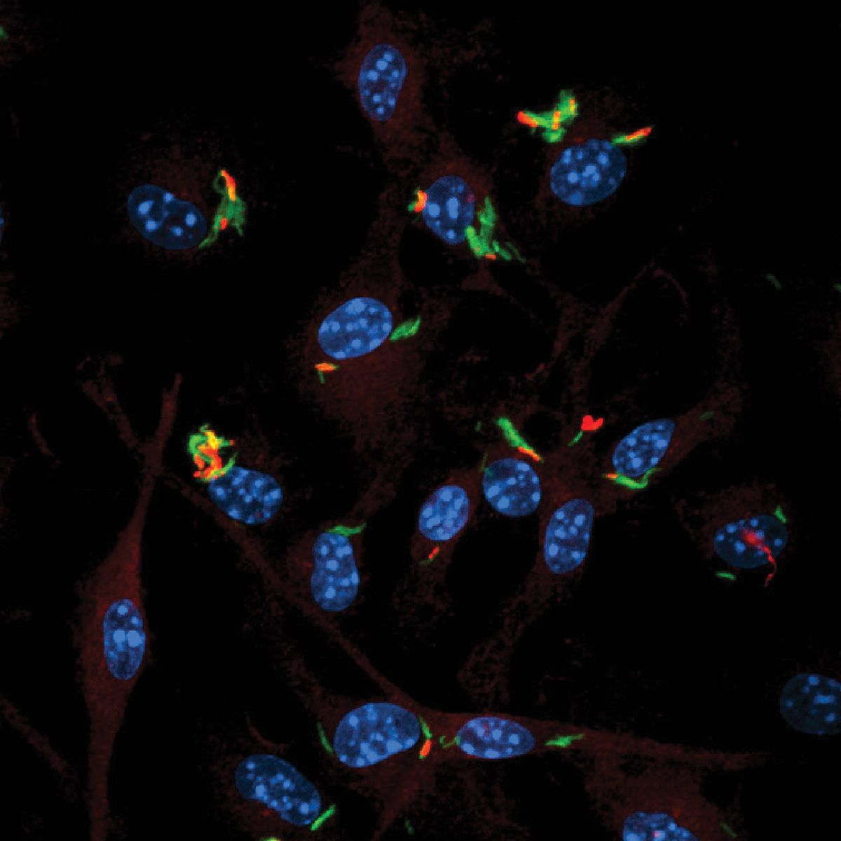 Cells infected with the pathogen Mycobacterium tuberculosis. Cells infected with the pathogen Mycobacterium tuberculosis.