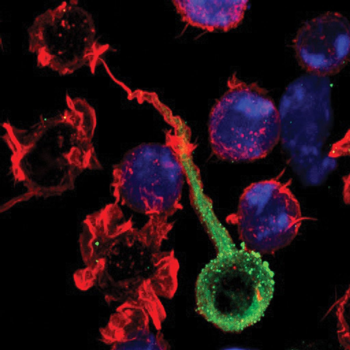 Immune cells are labeled with a red marker. HIV particles (green) from an infected cell are transferred to an uninfected cell via direct cell-to-cell contact. Immune cells are labeled with a red marker. HIV particles (green) from an infected cell are transferred to an uninfected cell via direct cell-to-cell contact.