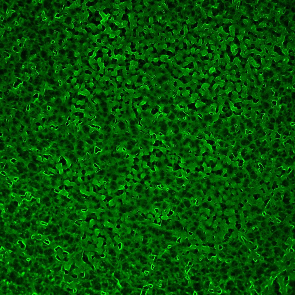 An image of a fluorescent protein from tick saliva forming a lattice structure. An image of a fluorescent protein from tick saliva forming a lattice structure.