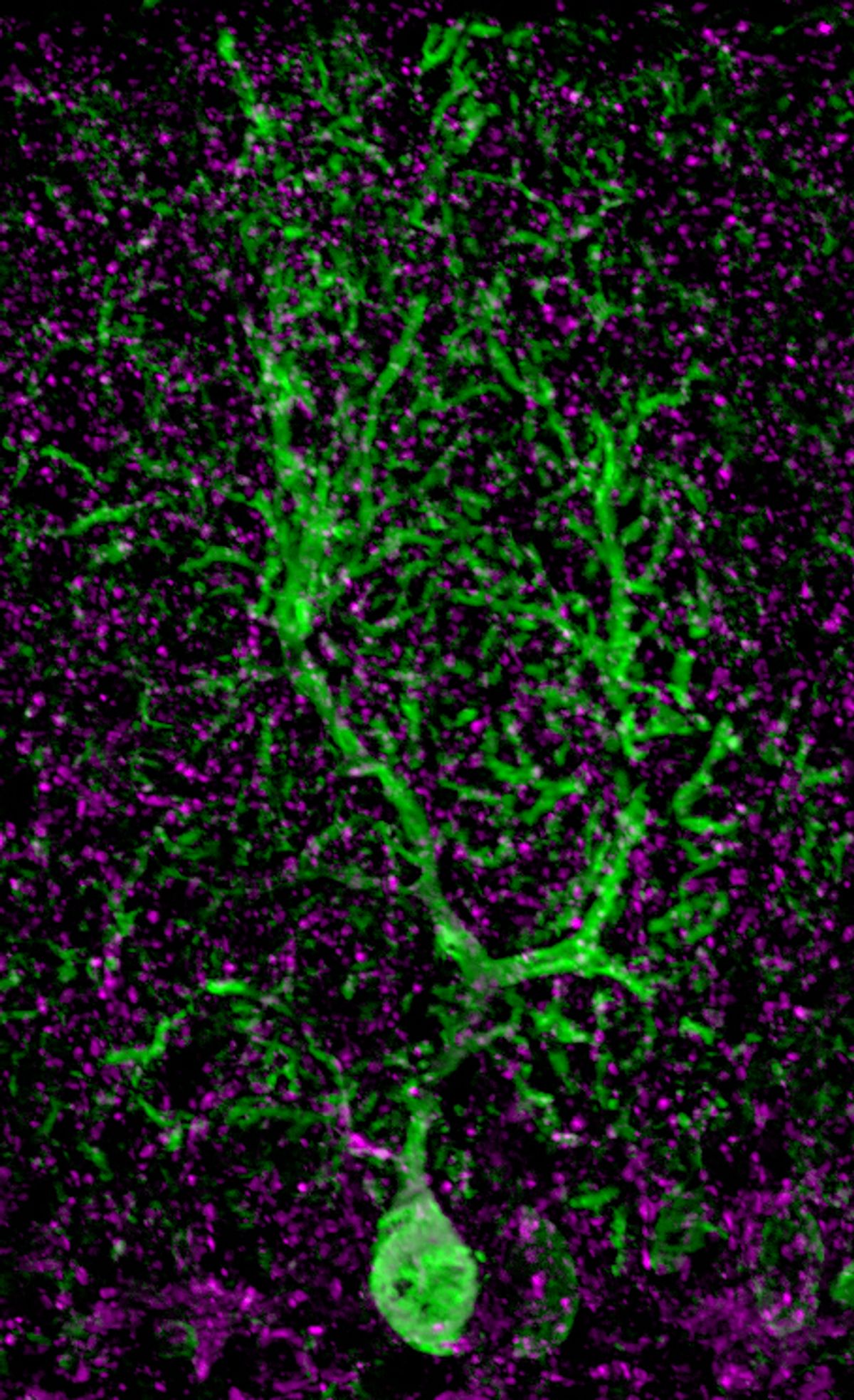 Fluorescent image of a highly branched Purkinje cell (green) surrounded by its neurotransmitter transporter (magenta). Fluorescent image of a highly branched Purkinje cell (green) surrounded by its neurotransmitter transporter (magenta).