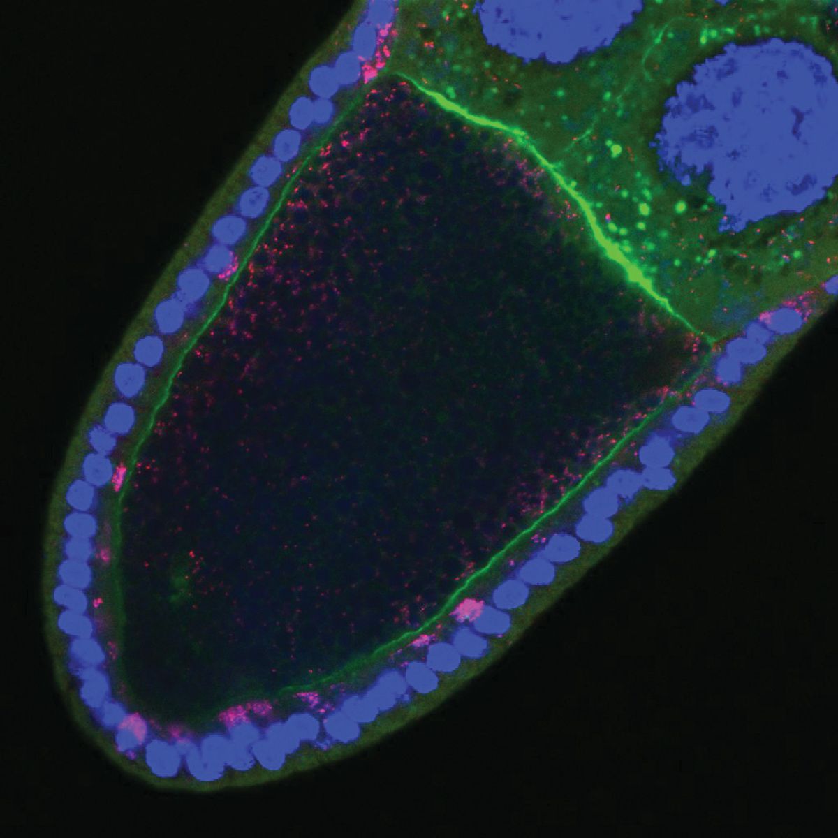 The image shows a fruit fly oocyte infected with Wolbachia bacteria. The image shows a fruit fly oocyte infected with Wolbachia bacteria.