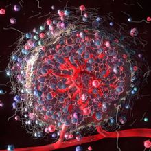 Cancer cell