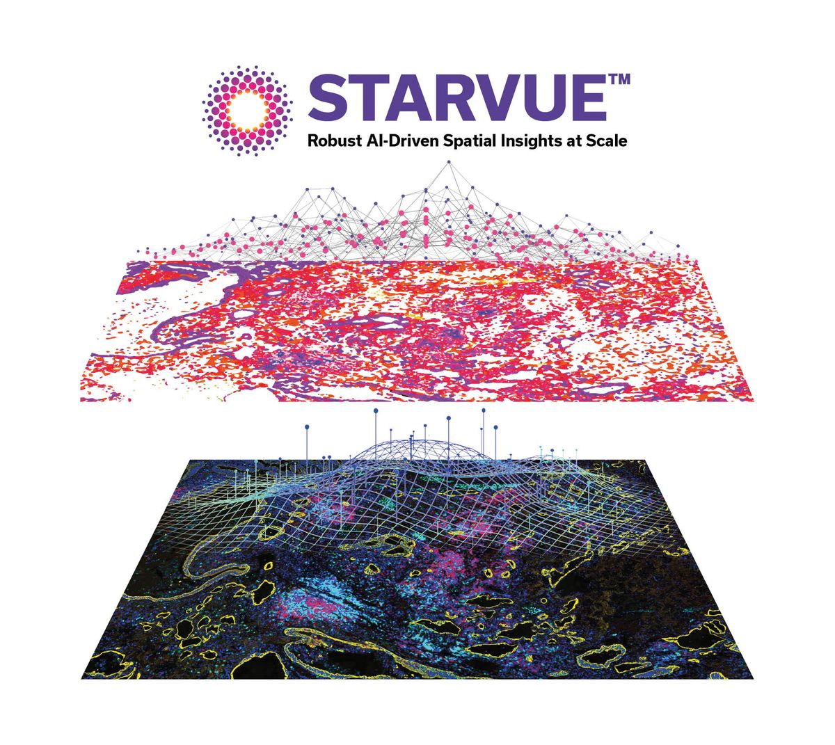 Image representing how the STARVUE program analyzes stained tissue Image representing how the STARVUE program analyzes stained tissue