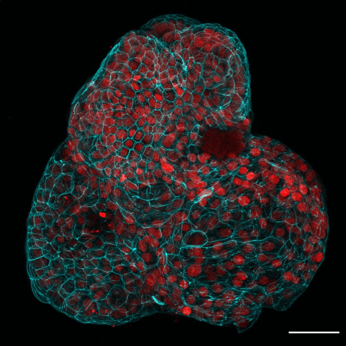Red cells encased in cyan webbing. Red cells encased in cyan webbing.