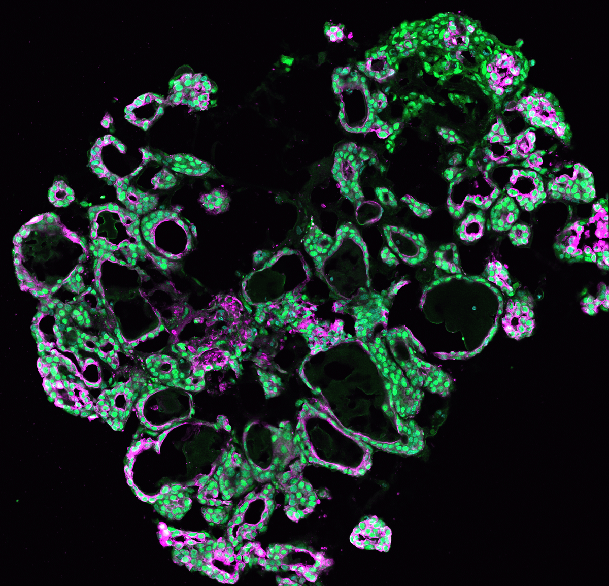 An image of cells with the center stained green and some cells stained magenta over a black background. An image of cells with the center stained green and some cells stained magenta over a black background.